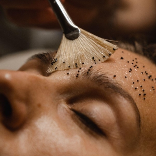 Skræddersyet ansigtsbehandling ved Klinik Windahl i Odense