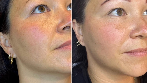 Før og efter permanent make-up i Pårup, Odense NV, ikke langt fra Munkebo og Langeskov