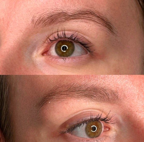 Før og ophelet resultatet permanent makeup