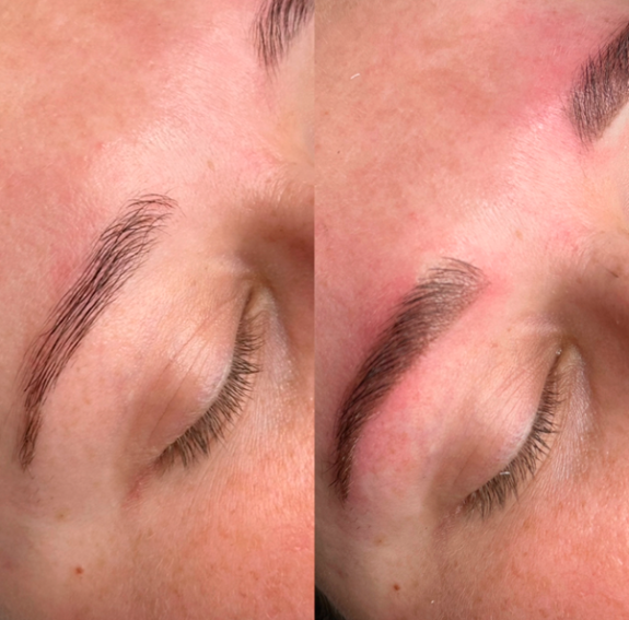 Før og efter permanent makeup